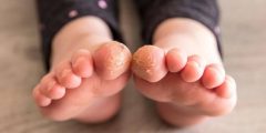 علاج تشقق القدمين عند الاطفال