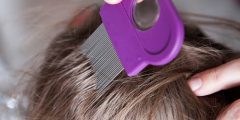القضاء على القمل والصيبان نهائيا وتنظيف الشعر